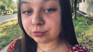 AllaFoxins Snapshot